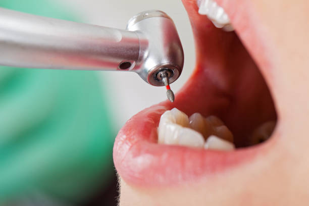 Best Tooth Infection Emergency Dentist  in North Lindenhurst, NY